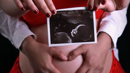 Badania prenatalne finansowane przez NFZ są teraz dostępne dla wszystkich przyszłych mam