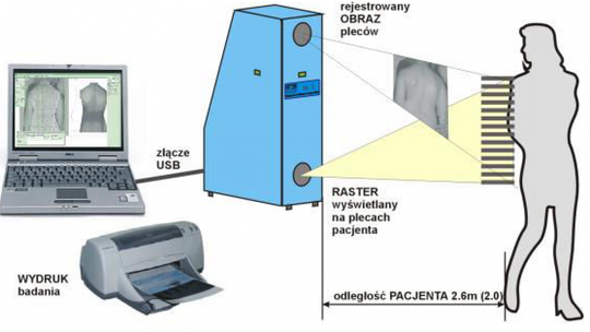 Bezpłatne badanie postawy dzieci i młodzieży szkolnej