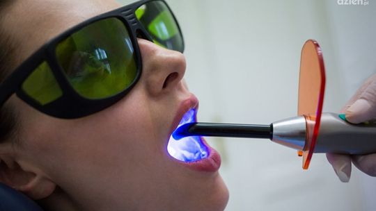 Lampa polimeryzacyjna w stomatologii - kluczowe narzędzie do utwardzania materiałów kompozytowych