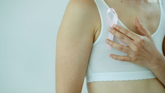 Mammografia – badanie przesiewowe raka piersi