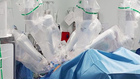 Robot da Vinci dla szpitala w Czerwonej Górze za ponad 10 mln zł! 