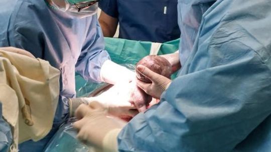 W starachowickim szpitalu na świat przyszły trojaczki 