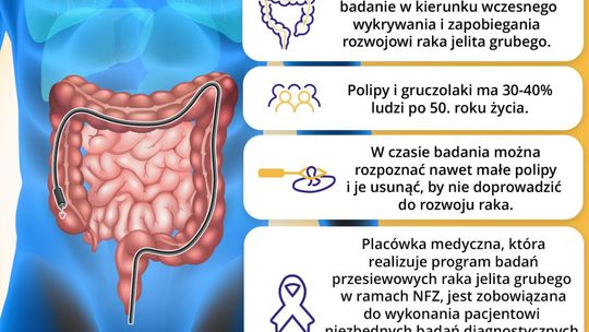 W województwie świętokrzyskim rozpoczął się bezpłatny program badań przesiewowych w kierunku raka jelita grubego