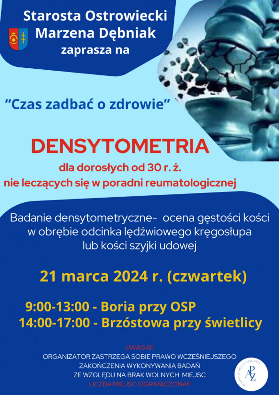 Bezpłatne badania densytometryczne w powiecie ostrowieckim Bezpłatne badania densytometryczne w powiecie ostrowieckim