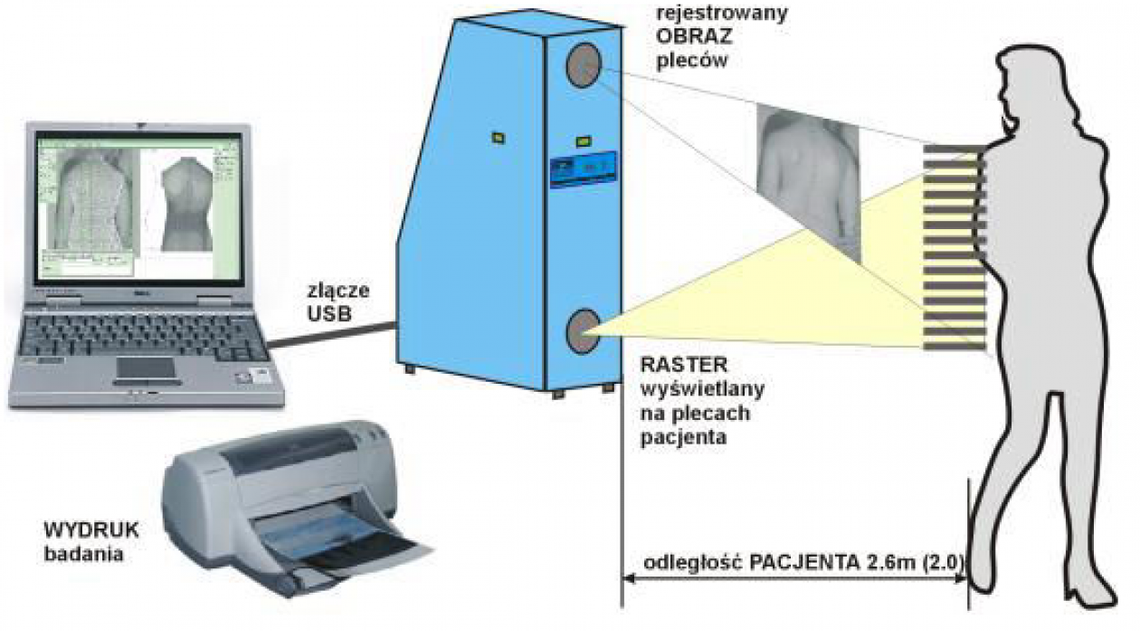 Bezpłatne badanie postawy dzieci i młodzieży szkolnej