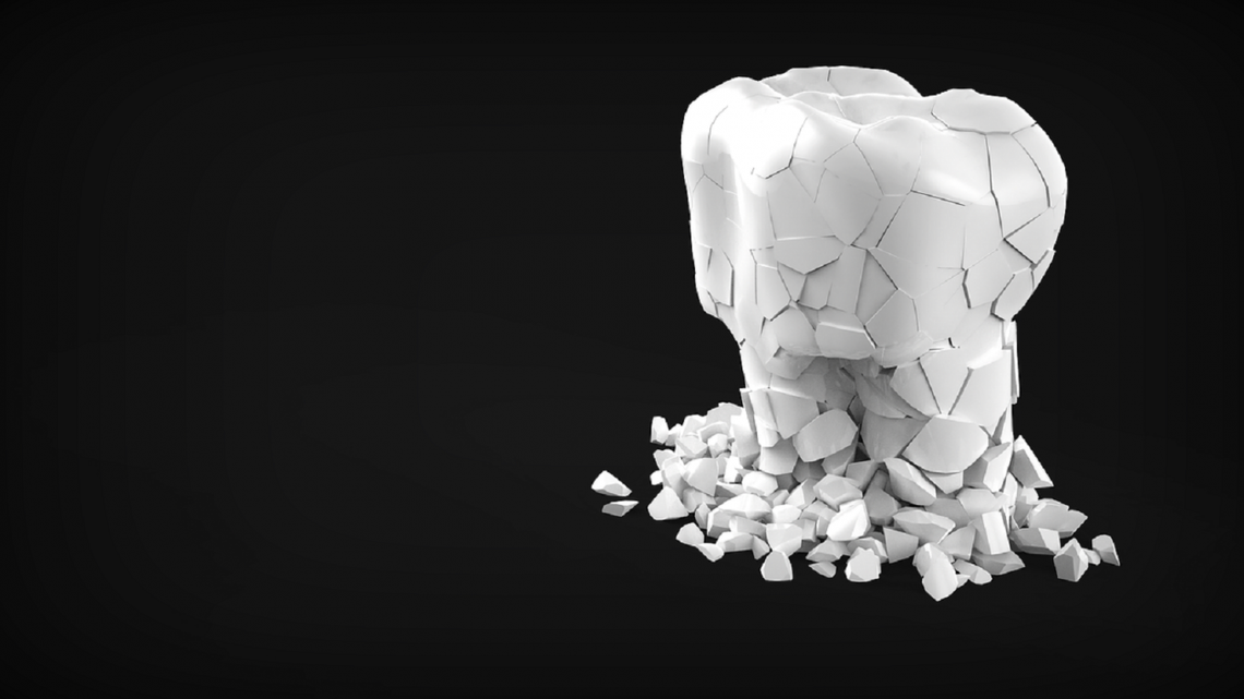 Co warto wiedzieć o implantach i leczeniu kanałowym? Co warto wiedzieć o implantach i leczeniu kanałowym?