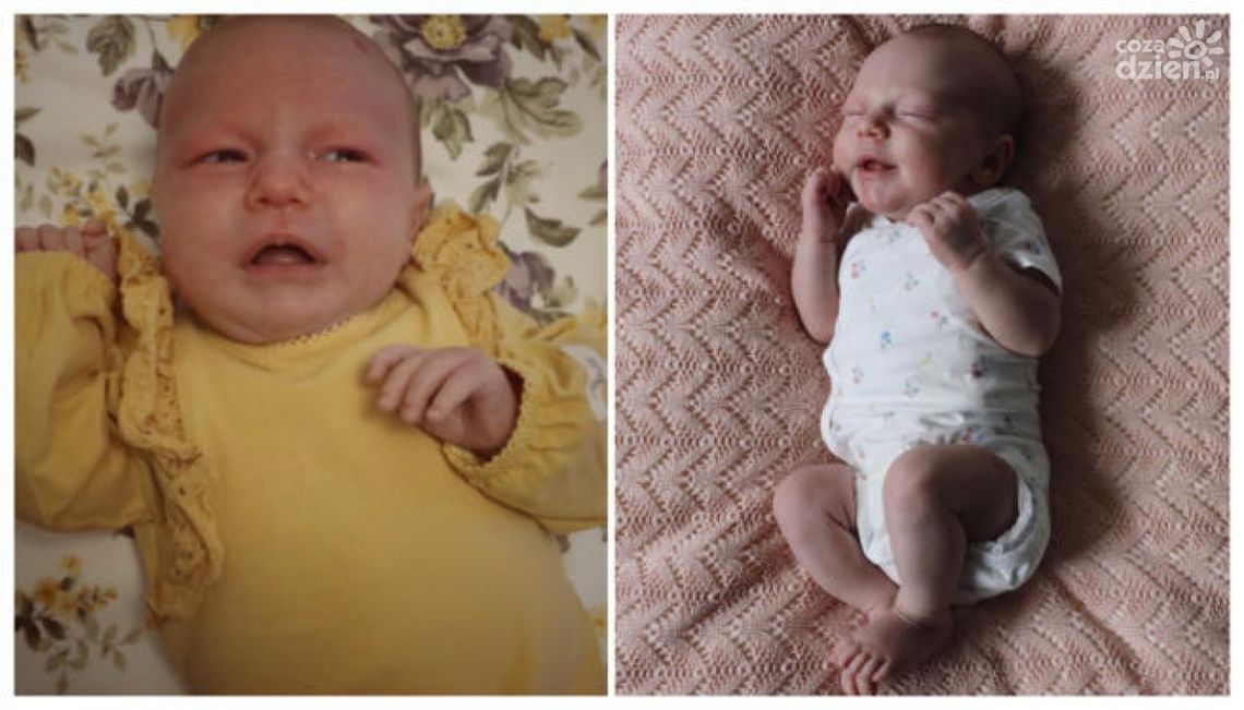 Miesięczna Gabrysia Dorocka walczy o życie i potrzebuje naszej pomocy Miesięczna Gabrysia Dorocka walczy o życie i potrzebuje naszej pomocy