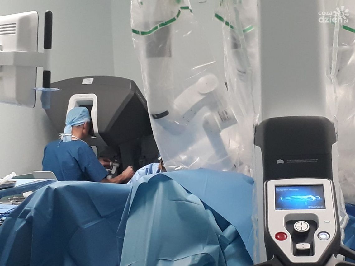 Pierwsza robotyczna operacja w Klinice Chirurgii Onkologicznej w ŚCO Pierwsza robotyczna operacja w Klinice Chirurgii Onkologicznej w ŚCO