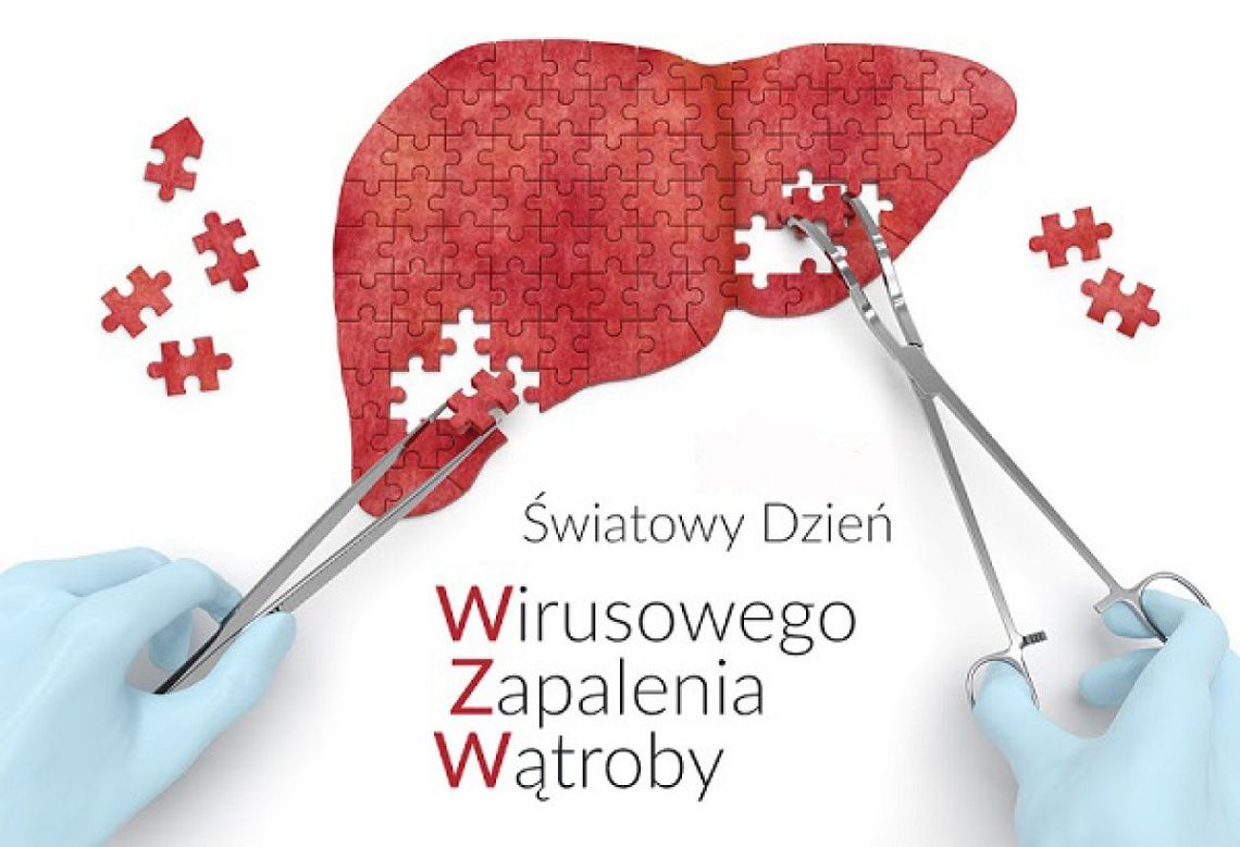 Sprawdź swoją wątrobę - bezpłatne badania w ŚCO Sprawdź swoją wątrobę - bezpłatne badania w ŚCO