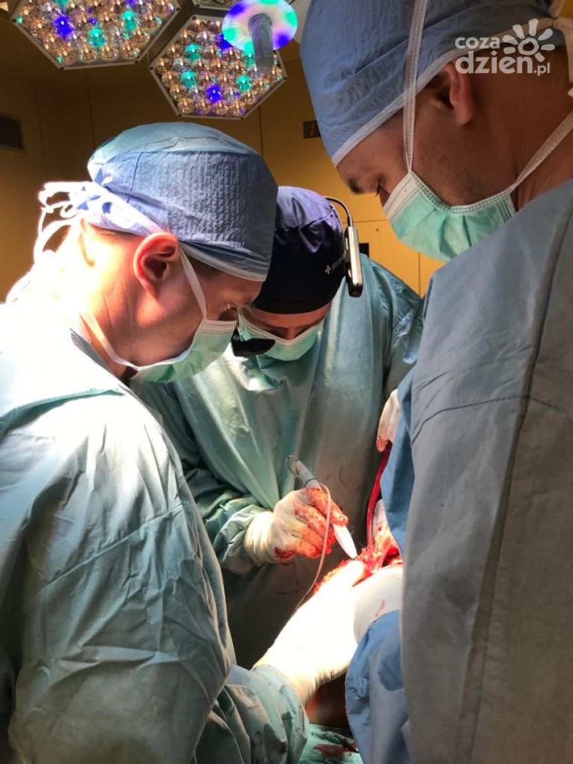 Sztuczna inteligencja pomogła w operacji Sztuczna inteligencja pomogła w operacji